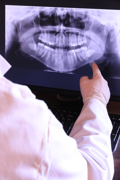 Best Pediatric Emergency Dentist in Lakeside, CA